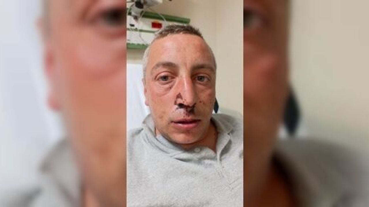 ENGELLİ VATANDAŞ SOKAK ORTASINDA DARBEDİLDİ