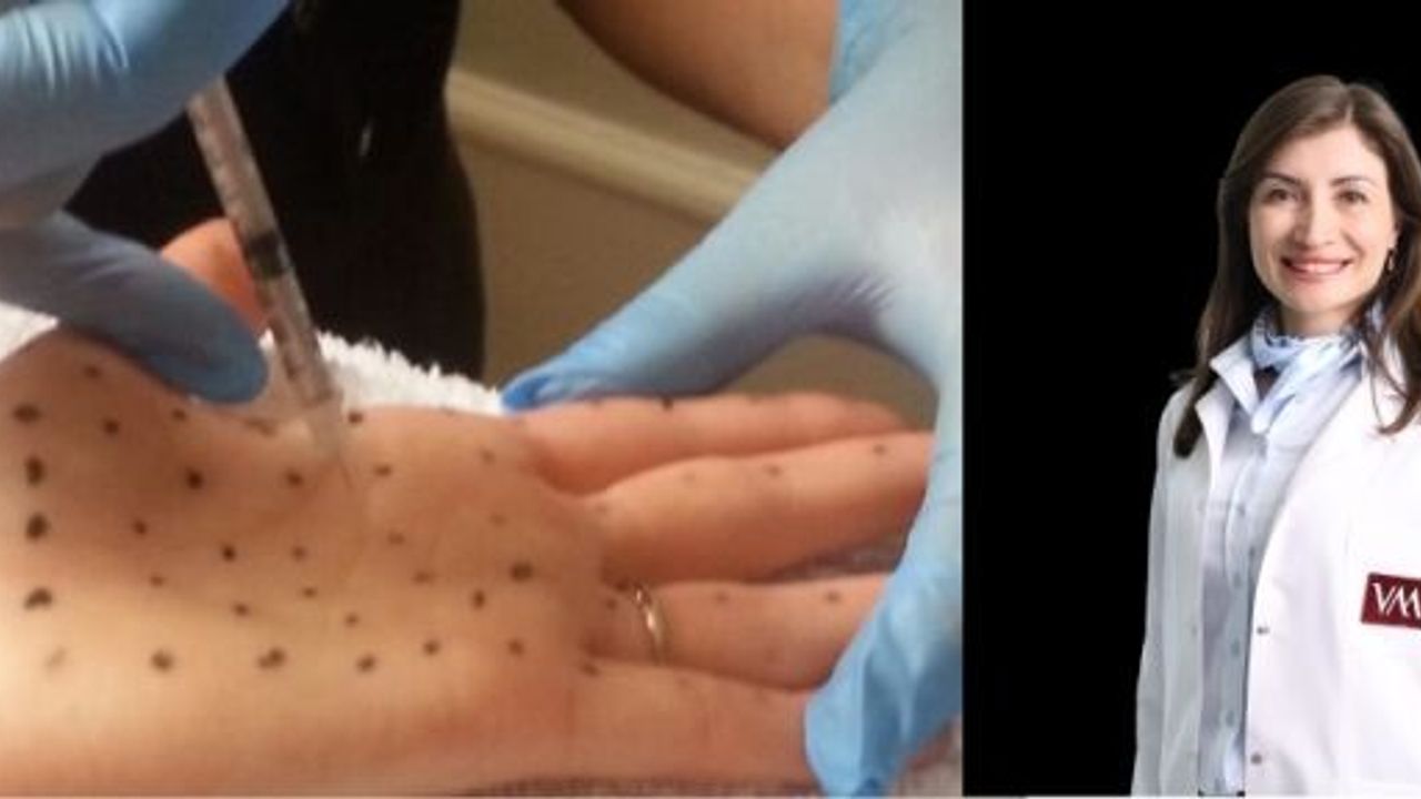 "Botoks Tedavisi İle Aşırı Terlemeden Kurtulmak Mümkün"