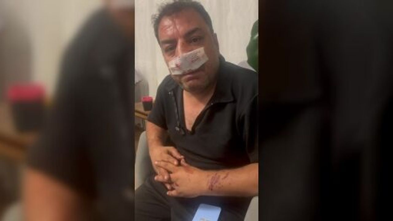 FAHİŞ FOTOĞRAF ÜCRETİNE İTİRAZ EDEN ŞOFÖRE YUMRUKLU SALDIRI