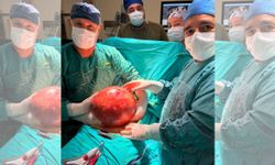 Doktorlar Gözlerine İnanamadı: 1,5 Yıl Ertelediği Ameliyatta Karnından Dev Kitle Çıktı