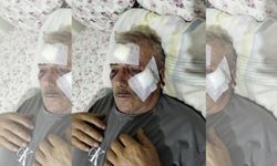 68 Yaşındaki Adamı Muştayla Darp Etti