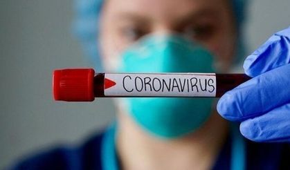 Bir Kişi Koronadan Öldü, 3 Kişi Tedavide