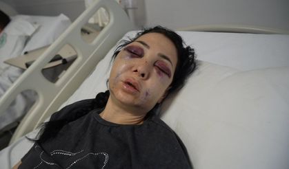 ''Küfür Etmeyin' Dedik Diye Bu Hale Geldim'