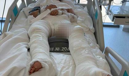 Genç Kıza Çarpıp Üzerinden Geçen Sürücü Tutuklandı