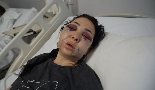 Oğlunun gözü önünde anneyi öldüresiye dövdüler: ''Küfür etmeyin' dedik diye bu hale geldim'